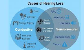 Common causes of hearing  loss