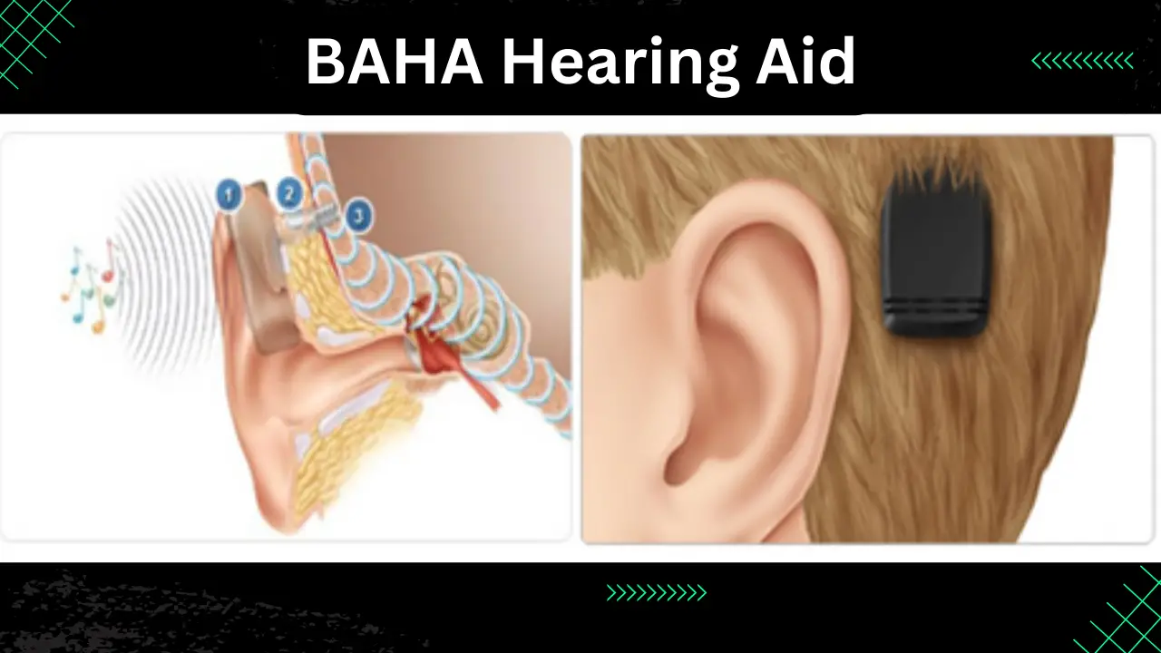 Baha Hearing Aid