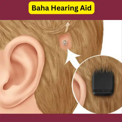 Baha Hearing Aid